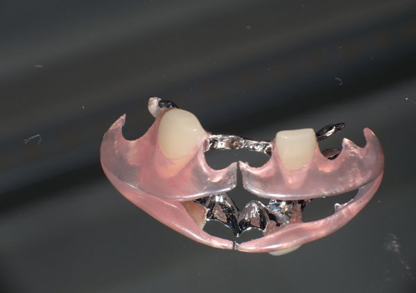 治療前